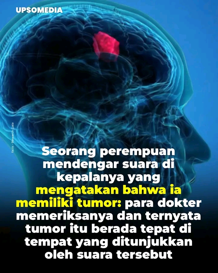 Viral Kisah Wanita Mendengar Suara yang Mengungkap Tumor Otak, Benarkah? Ini Fakta Medisnya